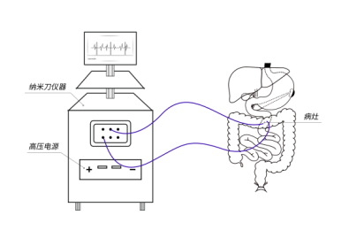 納米刀專(zhuān)用高壓電源_醫療